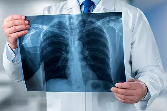 Imagen del curso Radiologia